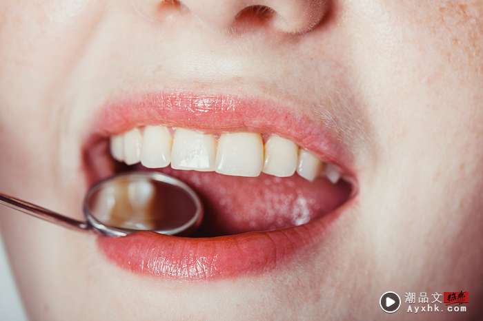 Tips I 食物经常塞牙缝？可能跟这5种口腔病有关 更多热点 图4张
